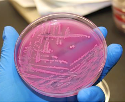 Stool Microbes Predict Advanced Liver Disease