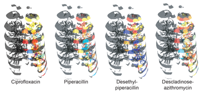 The Microbial Anatomy of an Organ