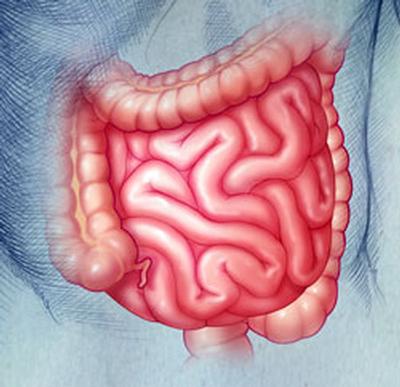Improving prediction accuracy of Crohn's disease based on repeated fecal sampling