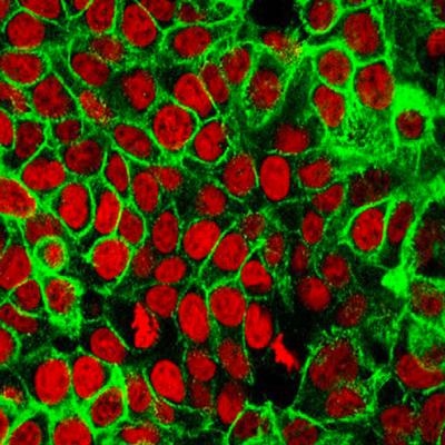 Exposing Cancer's Metabolic Addictions