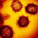 Coronavirus circulated undetected months before first COVID-19 cases in Wuhan, China