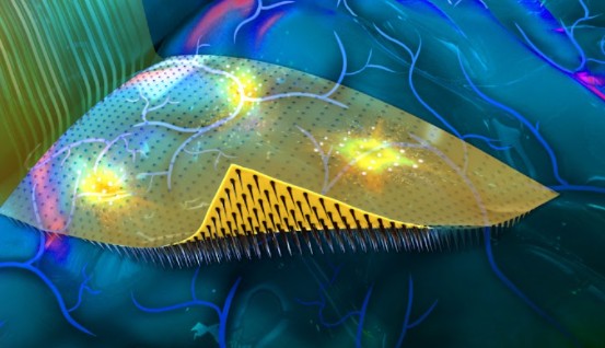 A new brain-computer interface with a flexible backing