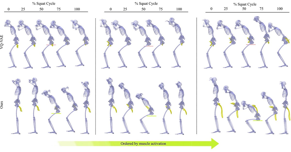 Generative AI Can Help Athletes Avoid Injuries