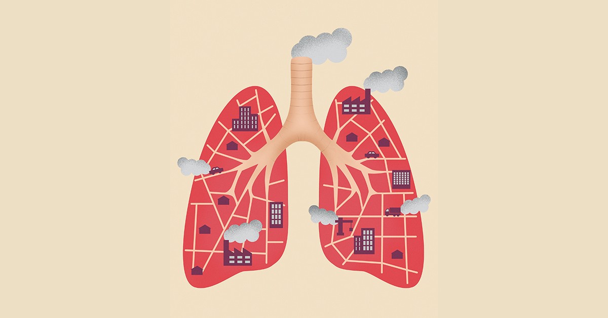 Air Pollution May Contribute to Development of Lung Cancer in Never-smokers, New Study Finds